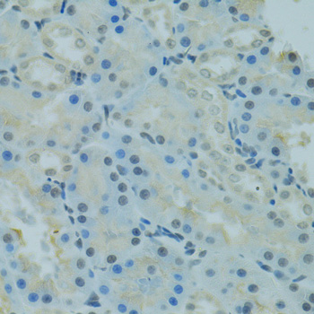 Immunohistochemistry of paraffin-embedded Rat kidney using PRDM2 Polyclonal Antibody at dilution of  1:100 (40x lens).