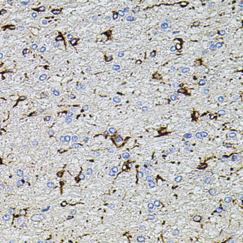 Immunohistochemistry of paraffin-embedded Rat brain using TRPA1 Polyclonal Antibody at dilution of  1:100 (40x lens).