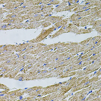 Immunohistochemistry of paraffin-embedded Rat heart using TRPA1 Polyclonal Antibody at dilution of  1:100 (40x lens).