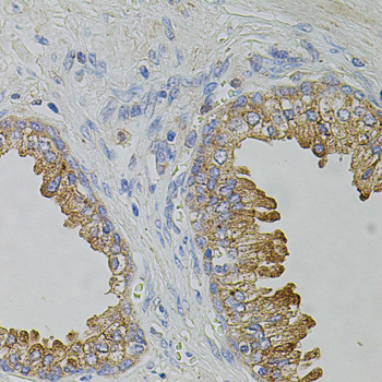 Immunohistochemistry of paraffin-embedded Human prostate using TRPA1 Polyclonal Antibody at dilution of  1:100 (40x lens).