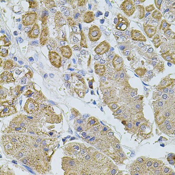 Immunohistochemistry of paraffin-embedded Human stomach using TRPA1 Polyclonal Antibody at dilution of  1:100 (40x lens).