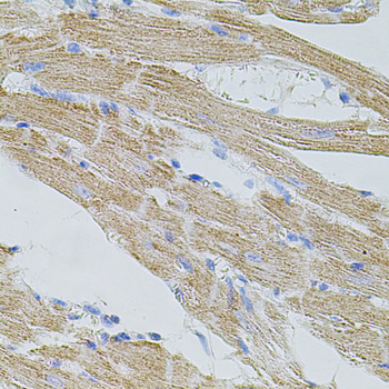 Immunohistochemistry of paraffin-embedded Mouse heart using TRPA1 Polyclonal Antibody at dilution of  1:100 (40x lens).