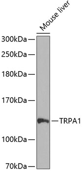 Western blot analysis of extracts of Mouse liver using TRPA1 Polyclonal Antibody at dilution of 1:1000.