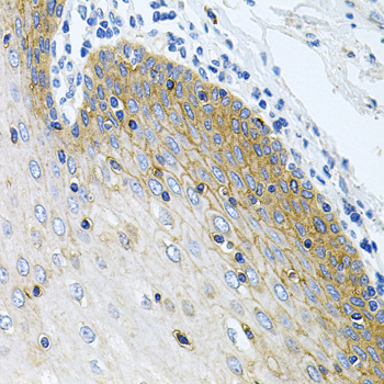 Immunohistochemistry of paraffin-embedded Human esophagus using GNE Polyclonal Antibody at dilution of  1:100 (40x lens).