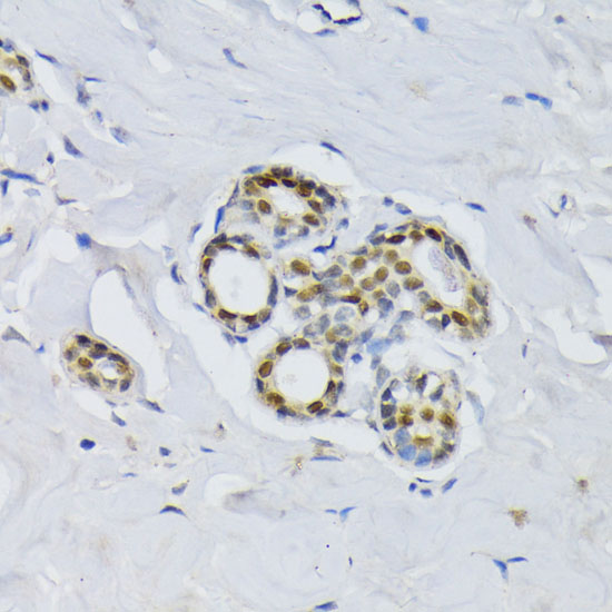 Immunohistochemistry of paraffin-embedded Human breast using BCCIP Polyclonal Antibody at dilution of  1:100 (40x lens).
