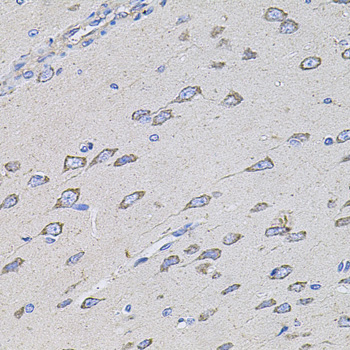 Immunohistochemistry of paraffin-embedded Rat brain using TMC1 Polyclonal Antibody at dilution of  1:100 (40x lens).