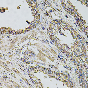 Immunohistochemistry of paraffin-embedded Human prostate using TMC1 Polyclonal Antibody at dilution of  1:100 (40x lens).