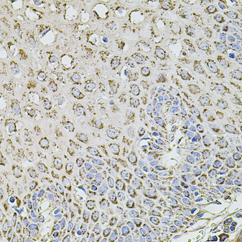 Immunohistochemistry of paraffin-embedded Human esophagus using TMC1 Polyclonal Antibody at dilution of  1:100 (40x lens).