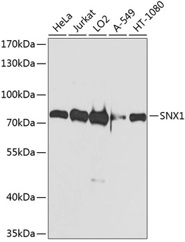 Western blot analysis of extracts of various cell lines using SNX1 Polyclonal Antibody at dilution of 1:1000.