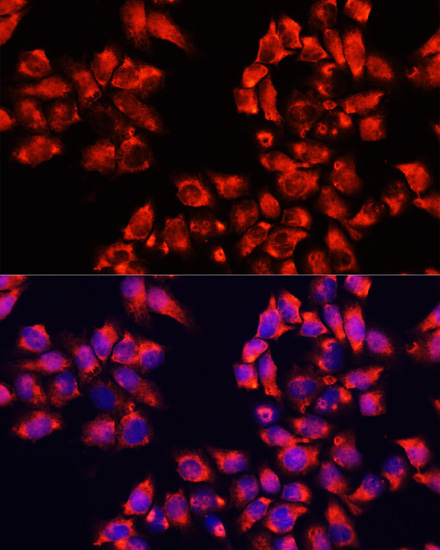 Immunofluorescence analysis of HeLa cells using ALDH7A1 Polyclonal Antibody at dilution of  1:100. Blue: DAPI for nuclear staining.