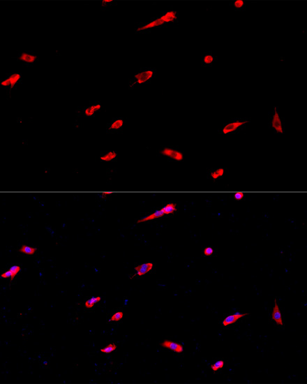 Immunofluorescence analysis of PC-12 cells using EIF3J Polyclonal Antibody at dilution of  1:100. Blue: DAPI for nuclear staining.