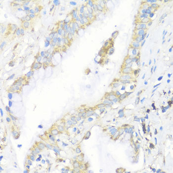 Immunohistochemistry of paraffin-embedded Human lung using EIF3J Polyclonal Antibody at dilution of  1:100 (40x lens).