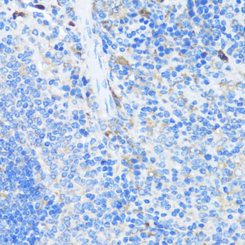 Immunohistochemistry of paraffin-embedded Mouse spleen using EIF3J Polyclonal Antibody at dilution of  1:100 (40x lens).