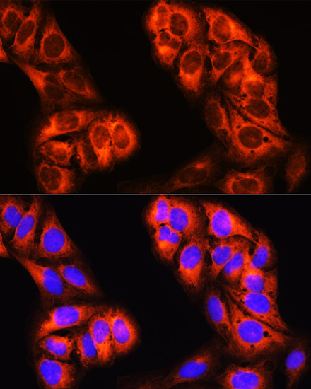 Immunofluorescence analysis of U-2 OS cells using MTHFD1 Polyclonal Antibody at dilution of  1:100 (40x lens). Blue: DAPI for nuclear staining.