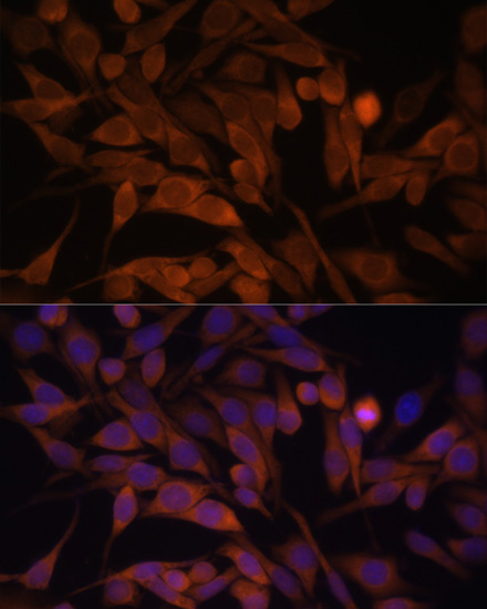 Immunofluorescence analysis of HeLa cells using CACYBP Polyclonal Antibody at dilution of  1:100. Blue: DAPI for nuclear staining.