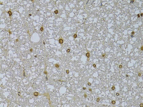 Immunohistochemistry of paraffin-embedded Rat spinal cord using HDGFRP3 Polyclonal Antibody at dilution of  1:100 (40x lens).