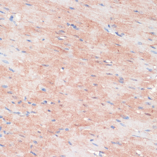 Immunohistochemistry of paraffin-embedded Rat heart using RPIA Polyclonal Antibody at dilution of  1:100 (40x lens).