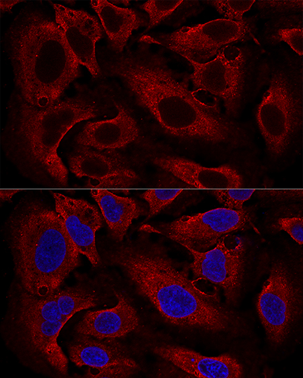 Confocal immunofluorescence analysis of U2OS cells using ARL8B Polyclonal Antibody at dilution of  1:100. Blue: DAPI for nuclear staining.