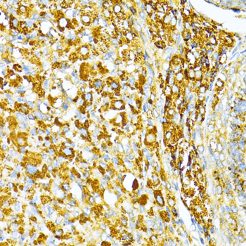 Immunohistochemistry of paraffin-embedded Rat ovary using VAMP1 Polyclonal Antibody at dilution of  1:100 (40x lens).