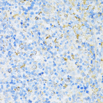 Immunohistochemistry of paraffin-embedded Rat spleen using VAMP1 Polyclonal Antibody at dilution of  1:100 (40x lens).