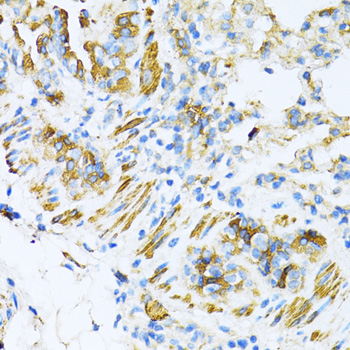 Immunohistochemistry of paraffin-embedded Mouse lung using VAMP1 Polyclonal Antibody at dilution of  1:100 (40x lens).