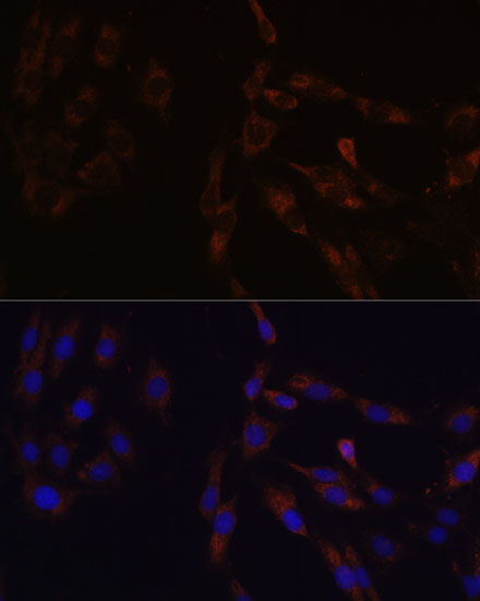 Immunofluorescence analysis of C6 cells using SUCLG2 Polyclonal Antibody at dilution of  1:100 (40x lens). Blue: DAPI for nuclear staining.