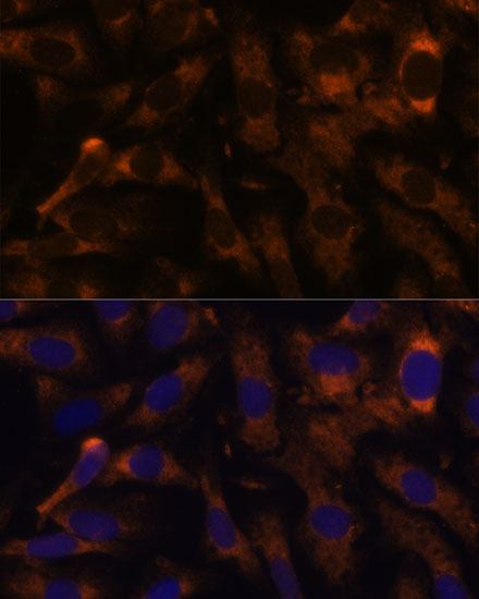 Immunofluorescence analysis of U-2 OS cells using SUCLG2 Polyclonal Antibody at dilution of  1:100 (40x lens). Blue: DAPI for nuclear staining.