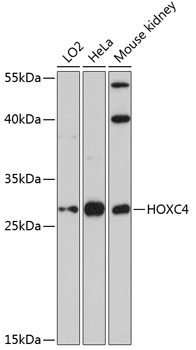 Western blot analysis of extracts of various cell lines using HOXC4 Polyclonal Antibody at dilution of 1:3000.