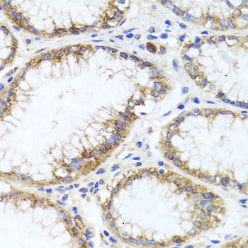 Immunohistochemistry of paraffin-embedded Human stomach using GPM6A Polyclonal Antibody at dilution of  1:100 (40x lens).