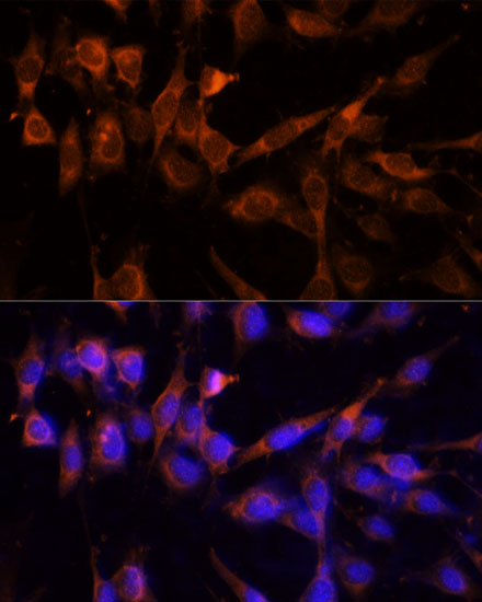 Immunofluorescence analysis of NIH-3T3 cells using YWHAH Polyclonal Antibody at dilution of  1:100 (40x lens). Blue: DAPI for nuclear staining.