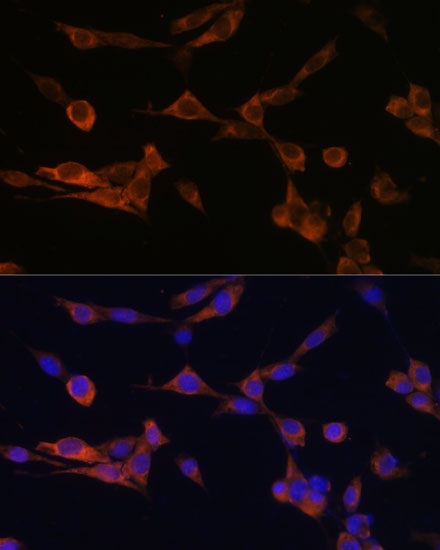 Immunofluorescence analysis of NIH-3T3 cells using YWHAH Polyclonal Antibody at dilution of  1:100 (40x lens). Blue: DAPI for nuclear staining.