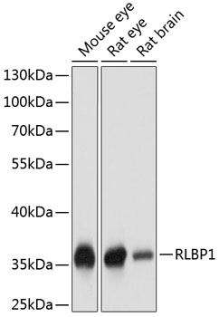 Western blot analysis of extracts of various cell lines using RLBP1 Polyclonal Antibody at dilution of 1:1000.