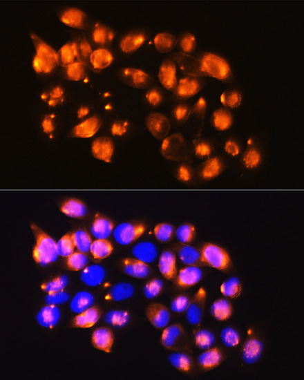 Immunofluorescence analysis of HeLa cells using EPB41L2 Polyclonal Antibody at dilution of  1:100. Blue: DAPI for nuclear staining.