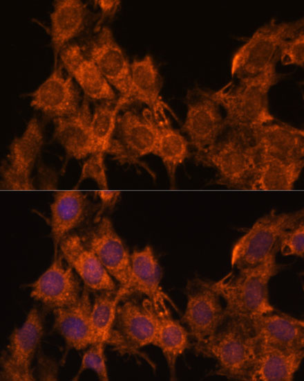 Immunofluorescence analysis of C6 cells using SNX15 Polyclonal Antibody at dilution of  1:100. Blue: DAPI for nuclear staining.