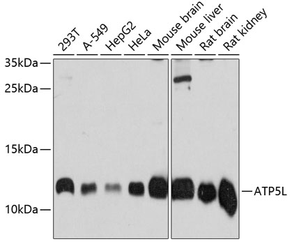 Western blot analysis of extracts of various cell lines using ATP5L Polyclonal Antibody at dilution of 1:3000.