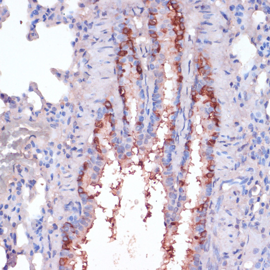 Immunohistochemistry of paraffin-embedded Rat lung using RPL22 Polyclonal Antibody at dilution of  1:100 (40x lens).