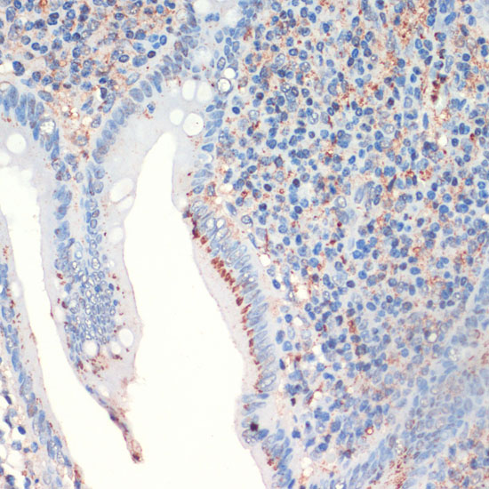 Immunohistochemistry of paraffin-embedded Human appendix using SST Polyclonal Antibody at dilution of  1:200 (40x lens).