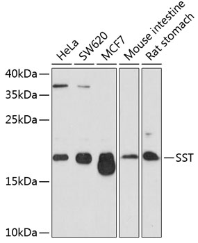 Western blot analysis of extracts of various cell lines using SST Polyclonal Antibody at dilution of 1:1000.