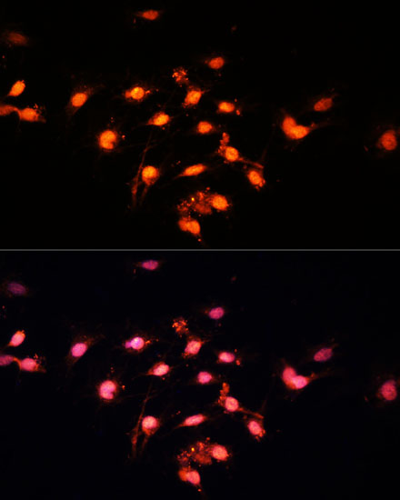 Immunofluorescence analysis of C6 cells using GTF3C4 Polyclonal Antibody at dilution of  1:100 (40x lens). Blue: DAPI for nuclear staining.