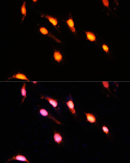 Immunofluorescence analysis of U-2 OS cells using GTF3C4 Polyclonal Antibody at dilution of  1:100 (40x lens). Blue: DAPI for nuclear staining.