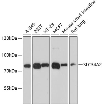 Western blot analysis of extracts of various cell lines using SLC34A2 Polyclonal Antibody at dilution of 1:3000.