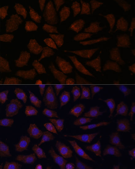 Immunofluorescence analysis of L929 cells using OAS3 Polyclonal Antibody at dilution of  1:100. Blue: DAPI for nuclear staining.