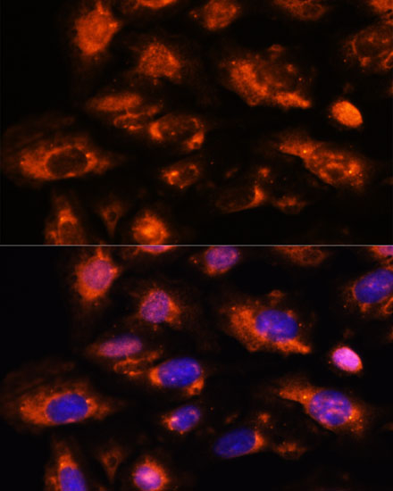 Immunofluorescence analysis of U-2 OS cells using OAS3 Polyclonal Antibody at dilution of  1:100. Blue: DAPI for nuclear staining.