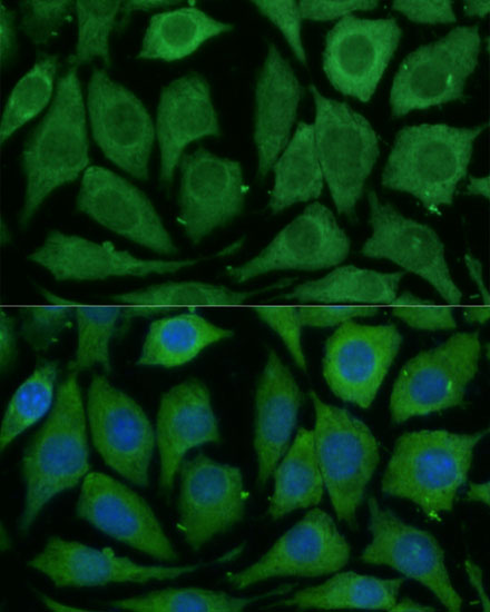 Immunofluorescence analysis of L929 cells using SARDH Polyclonal Antibody at dilution of  1:100 (40x lens). Blue: DAPI for nuclear staining.