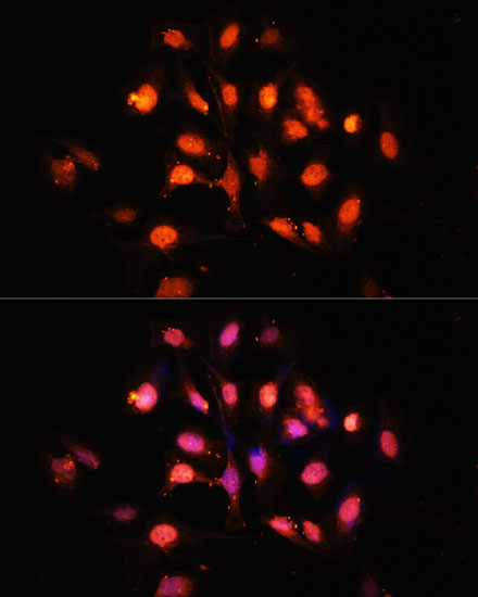 Immunofluorescence analysis of U-2 OS cells using PHLPP1 Polyclonal Antibody at dilution of  1:100 (40x lens). Blue: DAPI for nuclear staining.