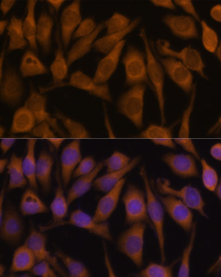 Immunofluorescence analysis of HeLa cells using UBQLN2 Polyclonal Antibody at dilution of  1:100 (40x lens). Blue: DAPI for nuclear staining.