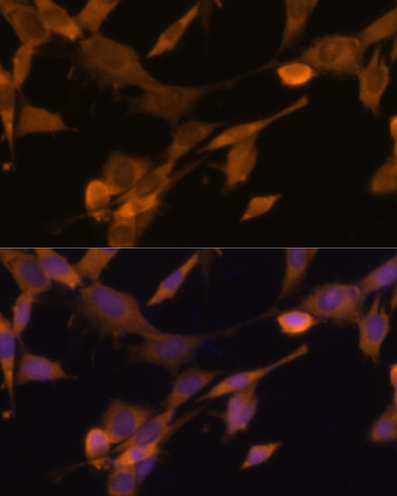 Immunofluorescence analysis of NIH-3T3 cells using UBQLN2 Polyclonal Antibody at dilution of  1:100 (40x lens). Blue: DAPI for nuclear staining.