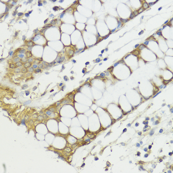 Immunohistochemistry of paraffin-embedded Human colon using HACE1 Polyclonal Antibody at dilution of  1:100 (40x lens).