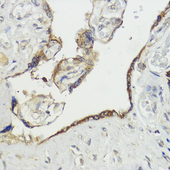 Immunohistochemistry of paraffin-embedded Human placenta using HACE1 Polyclonal Antibody at dilution of  1:100 (40x lens).