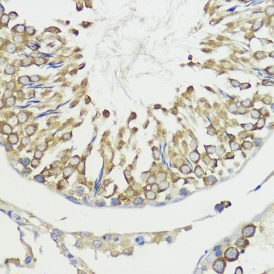 Immunohistochemistry of paraffin-embedded Rat testis using HACE1 Polyclonal Antibody at dilution of  1:100 (40x lens).